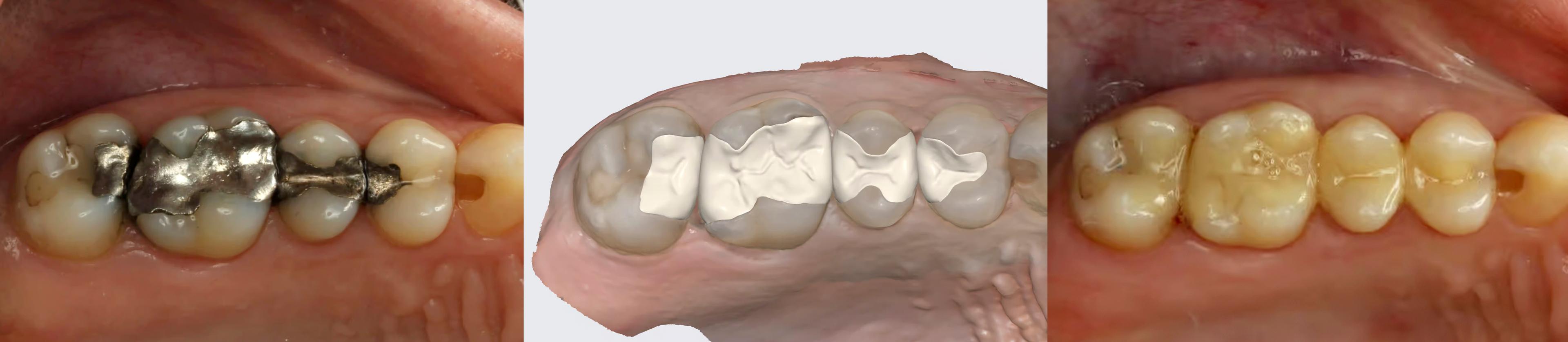beispiel_3d-druck-fuellung_quer